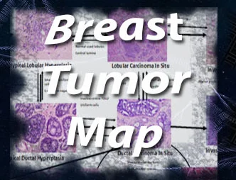 Breast Tumor Map