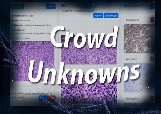 Crowd Unknowns